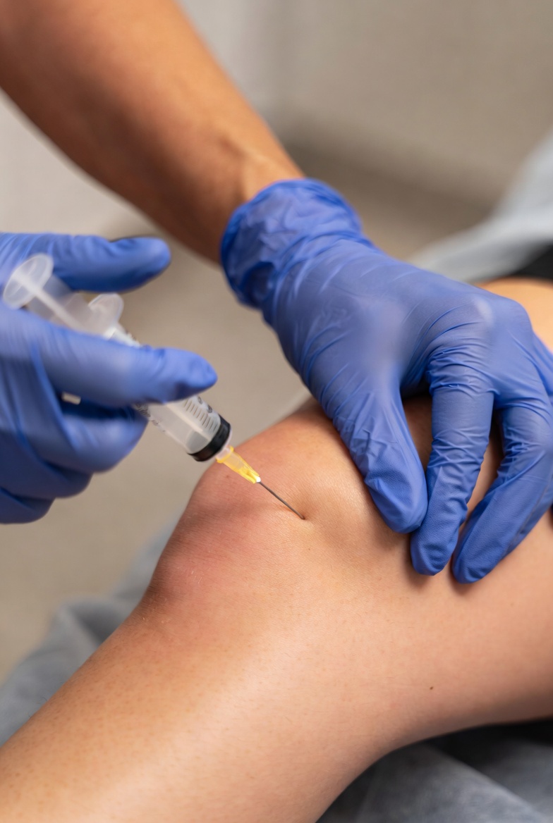 Infiltração articular no joelho - articulação femoropatelar e tibiofemoral